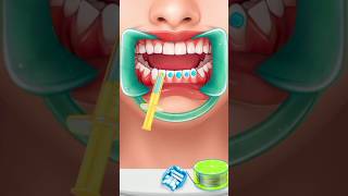 Dental cleaning dental scalingtiktok viralshorts video short shortsdentist dentalcaredental [upl. by Saturday162]