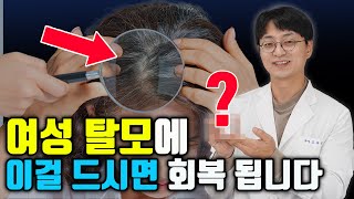 여성 탈모 약 대신 이걸 드시면 머리 숱이 풍성해집니다 여성탈모 갱년기성 탈모의 핵심 영양제 [upl. by Maltzman]