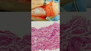 Connective Tissue I its type and functions studynotes animaltissue ytshort biology neet [upl. by Ecilef]