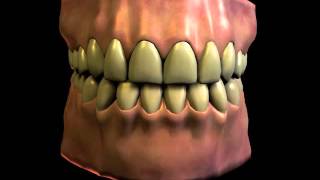 Dental Bruxism Teeth Grinding [upl. by Aisile692]