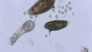 Schistosoma mansoni mother sporocyst and eggs [upl. by Negaem]