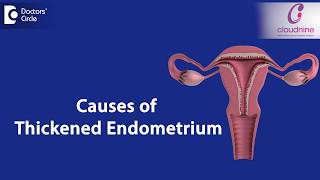 What causes Endometrial thickness  DrSmitha Sha of Cloudnine Hospitals  Doctors Circle [upl. by Dempstor222]