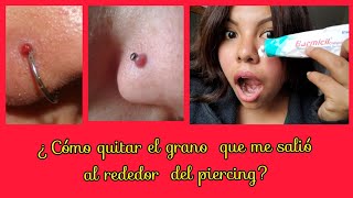 ¿Cómo quitar granobultoqueloide que me salió al rededor del piercing [upl. by Karwan]