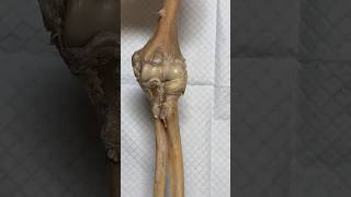 Elbow joint movement medical ortho bone knowledge bihar bio [upl. by Sevein]