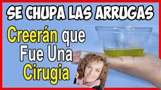 el mejor aceite CHUPA ARRUGAS Y ELIMINADOR DE MANCHAS [upl. by Adyam517]