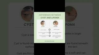 Cystic Acne vs Lipoma acne jerawat drlyna prplututdrlyna prplututklinikprimernilampuri [upl. by Nolita793]