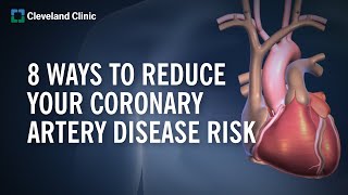 8 Ways to Reduce Your Coronary Artery Disease Risk [upl. by Russon]