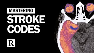 Mastering Stroke Codes [upl. by Kelcy]