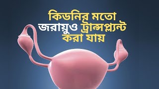 কিডনির মতো জরায়ুও ট্রান্সপ্লান্ট করা যায়। Uterus Transplant। Dr Saklayen Russel [upl. by Acimaj]