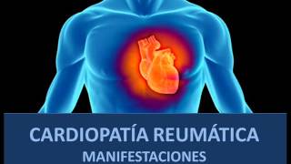 Cardiopatía reumática  Manifestaciones [upl. by Editha]