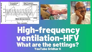 High frequency ventilation l Settings on HFV [upl. by Lanti933]