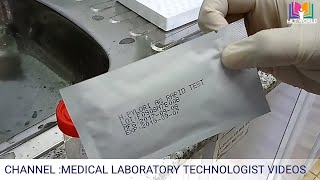 HPylori antigen rapid test in laboratoryHelicobacter pylori testHindi amp Urdu [upl. by Pammie]