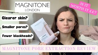 MAGNITONE Pore Extraction System Review  Athome Microdermabrasion dupe [upl. by Carrissa845]