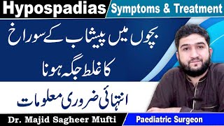 Hypospadias CausesSymptoms And Treatment In Urdu [upl. by Yrahca]