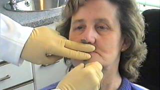 Denture Procedure [upl. by Appleby]