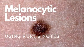 Melanocytic Lesions Kurtâ€™s Notes pathagonia [upl. by Parthenia850]