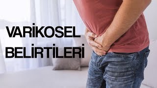 Varikosel Belirtileri [upl. by Allemac]