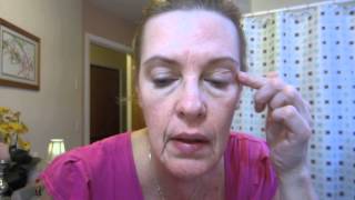 7 Month Retin A Anti Aging Skin Care Update [upl. by Avivah]