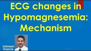 ECG changes in Hypomagnesemia Mechanism [upl. by Dabbs]