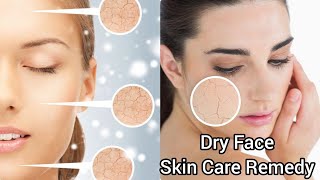 Winter Special Dry Cream  How to remove Face dryness in Winters Dry Face Skin Care Home Remedies [upl. by Hannazus]