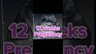 12 weeks Pregnancy scan  Anomaly Scan  Normal Obs  first strimester 1st [upl. by Einhpets703]