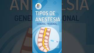 😴 TIPOS DE ANESTESIA LOCAL REGIONAL EPIDURAL Y GENERAL [upl. by Ateloiv]