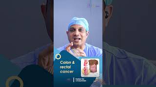 How Is Colon Cancer Treated  Insights from Dr Nilesh chordiya SSO [upl. by Aible660]