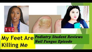 Podiatry Student reviews Brandon Never Washes His Feet  My Feet Are Killing Me nailfungus [upl. by Claudianus653]