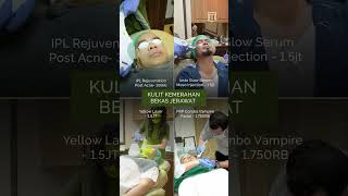 Pilih treatment sesuai dengan kondisi kulit lo dan booking sekarang✨ [upl. by Nossaj567]