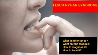 Lesch Nyhan Syndrome  Features Diagnosis Treatment Inheritance [upl. by Ortrud]