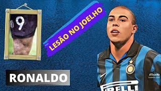 RONALDO FENÔMENO E A LESÃO GRAVE NO JOELHO [upl. by Liahus]