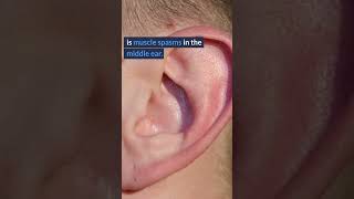 Tinnitus EXPOSED  Surprising Causes of Ringing in Ears 6 [upl. by Meletius]