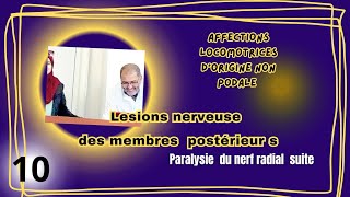 Lesions nerveuses des membres postérieurs  paralysie du nerf radial suite [upl. by Toft]