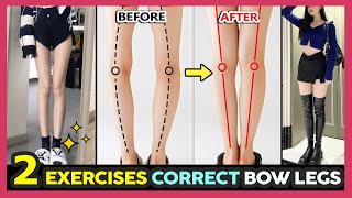 🔥ONLY 2 EXERCISES TO FIX BOW LEGS amp O Shaped Legs  Make your legs straighter fast and easy [upl. by Notslah911]