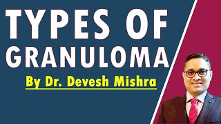 Types of Granuloma by Dr Devesh Mishra [upl. by Guildroy121]