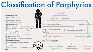 Classification of Porphyrias  What are Porphyrias and their classification [upl. by Korwun459]