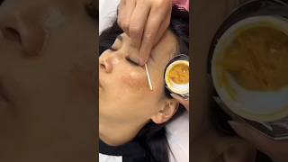 dark spots on face removal shorts skin beautytips [upl. by Walford]