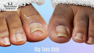 👣Big Toes Only  Pedicure TOENAIL CLEANING at Home👣 [upl. by Ehtylb]