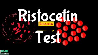 Ristocetin Test  Ristocetin Assay  Ristocetininduced Platelet Aggregation  RIPA [upl. by Yaffit]