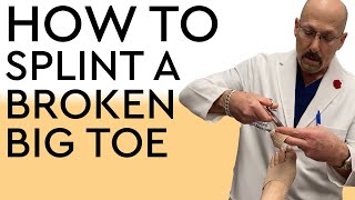 How to Splint a Broken Big Toe [upl. by Silenay]