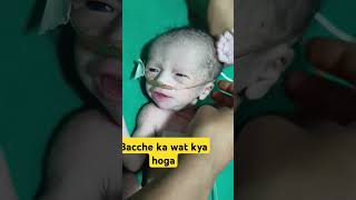 Oxygen by nasal cannula newborn ojha trending [upl. by Ravi]