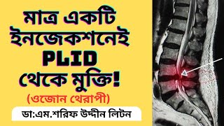 Disc Bulge Treatment Without Surgery  PLID Disc Herniation  DrMSharif Uddin Liton [upl. by Essirahs]