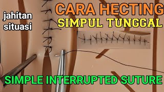 CARA TEKNIK HECTING SIMPUL TUNGGAL ATAU JAHIT SIMPLE INTERRUPTED SUTURE [upl. by Oeflein874]