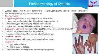 General Examination Cyanosis  Recognizing the Blue Tint  A Guide to Clinical Examination [upl. by Lyrpa]