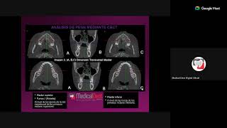 Tomografía Cone Beam para ortodoncia [upl. by Lleinad229]