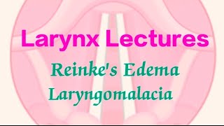 Reinkes Edema  Laryngomalacia [upl. by Yesdnil]