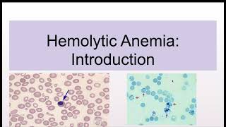 Hemolytic Anemias Introduction and Classification [upl. by Arihsaj]