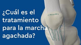 ¿Cuál es el tratamiento para la marcha agachada [upl. by Ecirtnuahs]