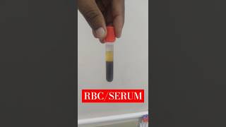 RBC and serum centrifuge blood machine lab cbc labrador dmlt medical equipment [upl. by Naivaf650]