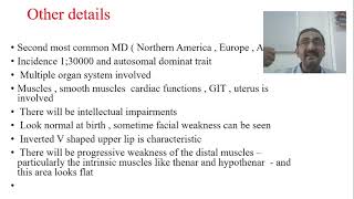 Muscular Dystrophy  Myotonic Dystrophy  Part 10 [upl. by Yllet]